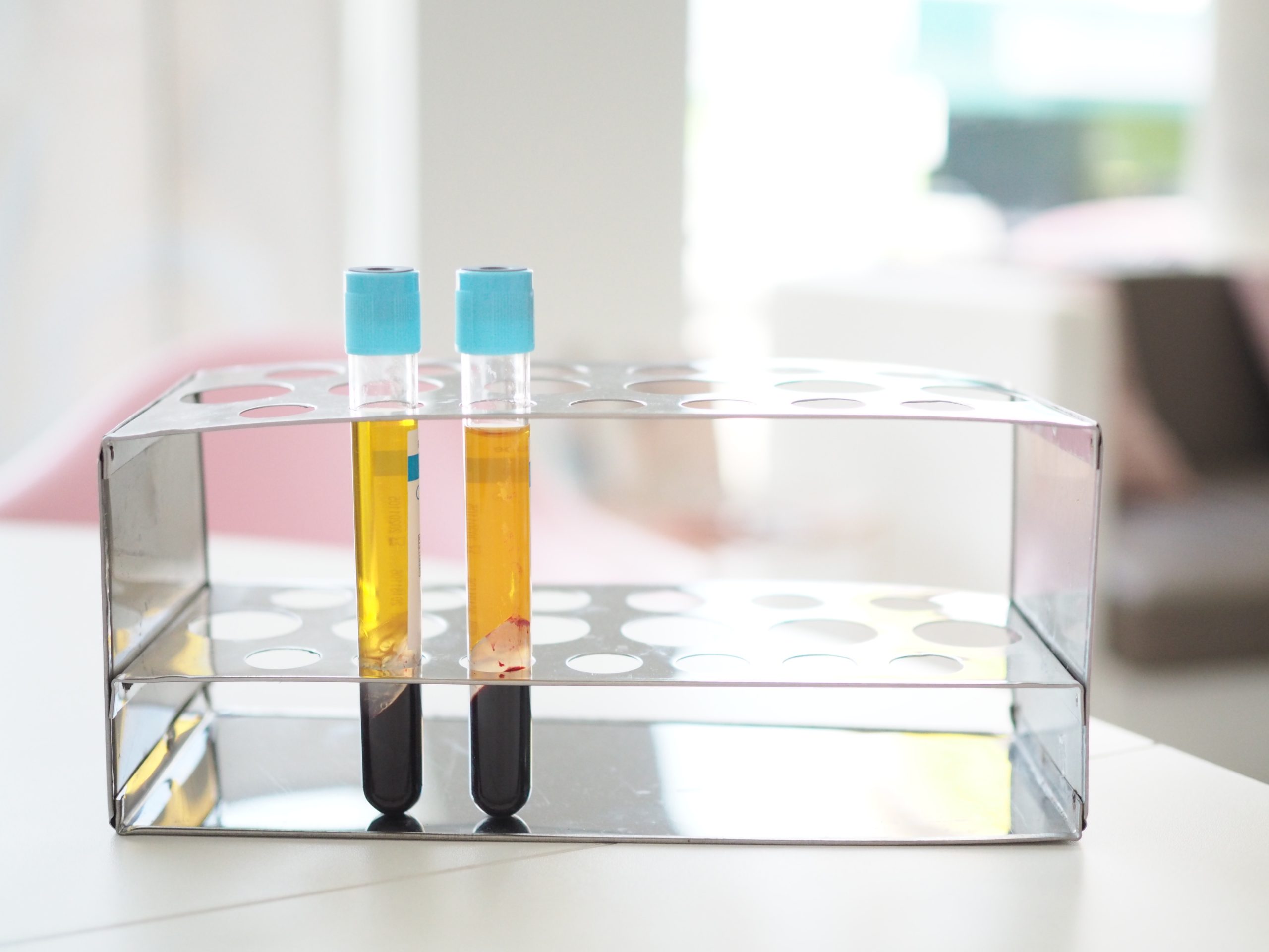 PRP injections